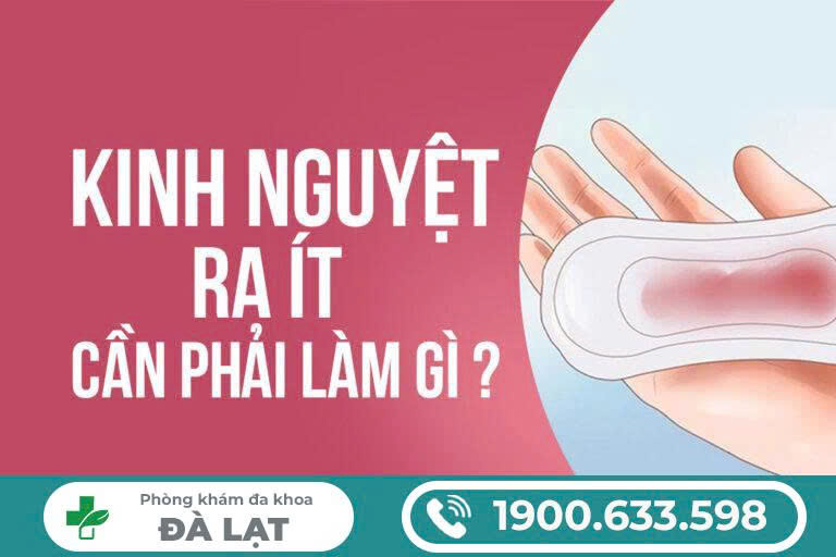 Hình ảnh minh họa